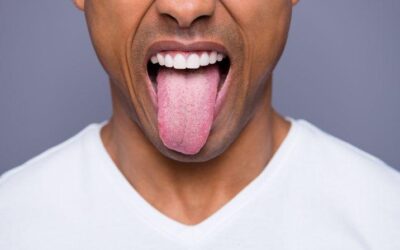 Blog 6 Vaper’s Tongue: What It is, how People get it and Cures for It