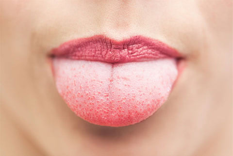 Vaper’s Tongue: What It is, how People get it and Cures for It 1 vapers tongue female